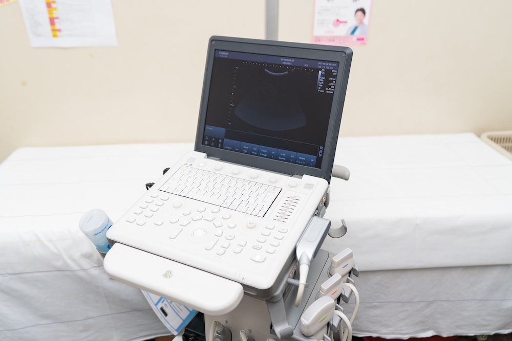 腹部エコー